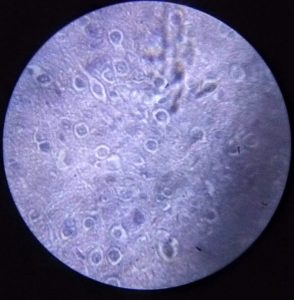 Microscopic image of a cell.