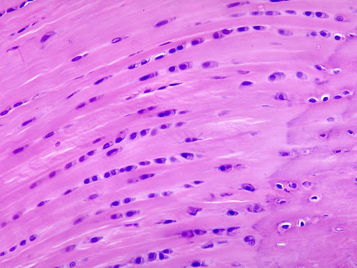 Picture of Fibrocartilage through a microscope. 