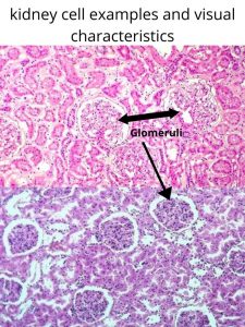 Image of a kidney cell.