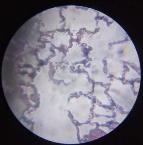 Lung tissue image