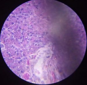 Stomach tissue image.